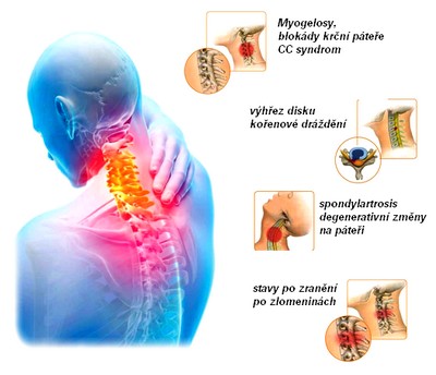 obsah-07-CTh-spine-syndroms.jpg