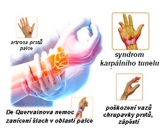 obsah-apo-wrist-anatomy.jpg
