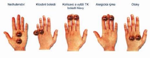 obsah03-mk-reflex-indikace-jedna.jpg