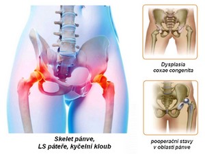 obsah-hip-joint-pelvis.jpg