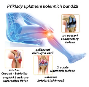 obsah01-knee-laesions.jpg