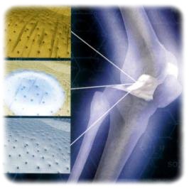 obsah01-knee-rtg.jpg