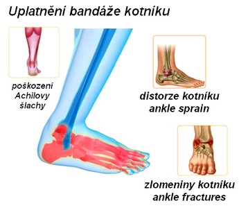 obsah07-ancle-joint.jpg