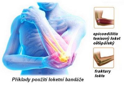 obsah08-elbow-injury.jpg