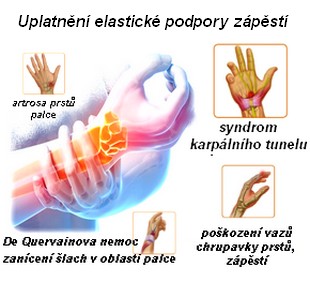obsah08-wrist-anatomy.jpg