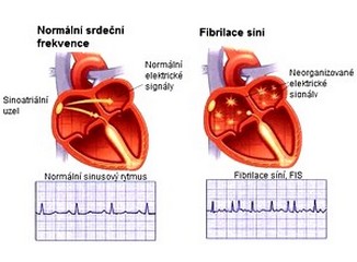 obsah-10-fisi.jpg