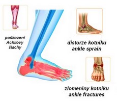 obsah-apo-ancle-joint.jpg
